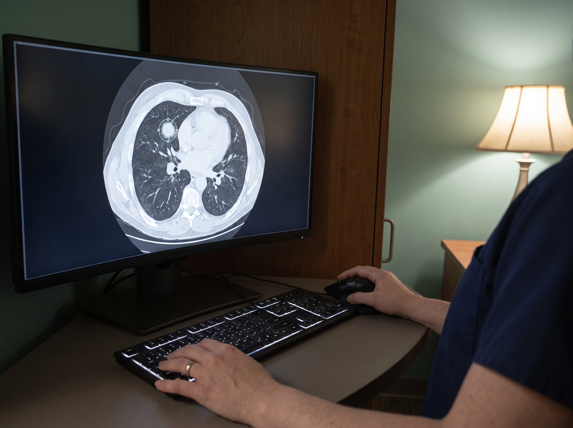 Chest CT scan on a computer screen